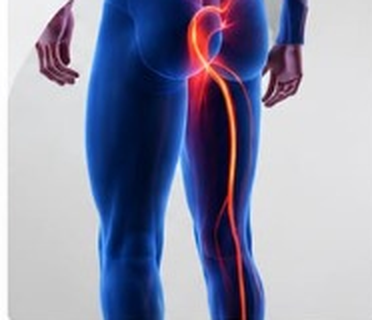 Sciatica & Back Pain