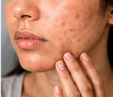 Skin & Hair Problems